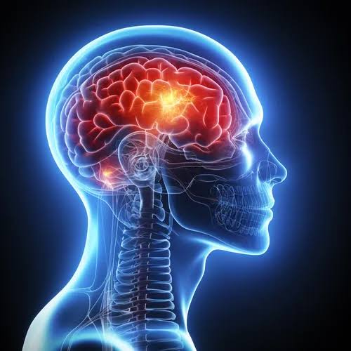 Post-Stroke Rehab: When to Start and What to Expect